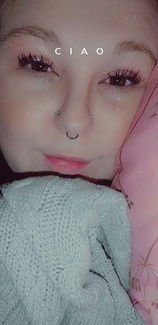 Freckles